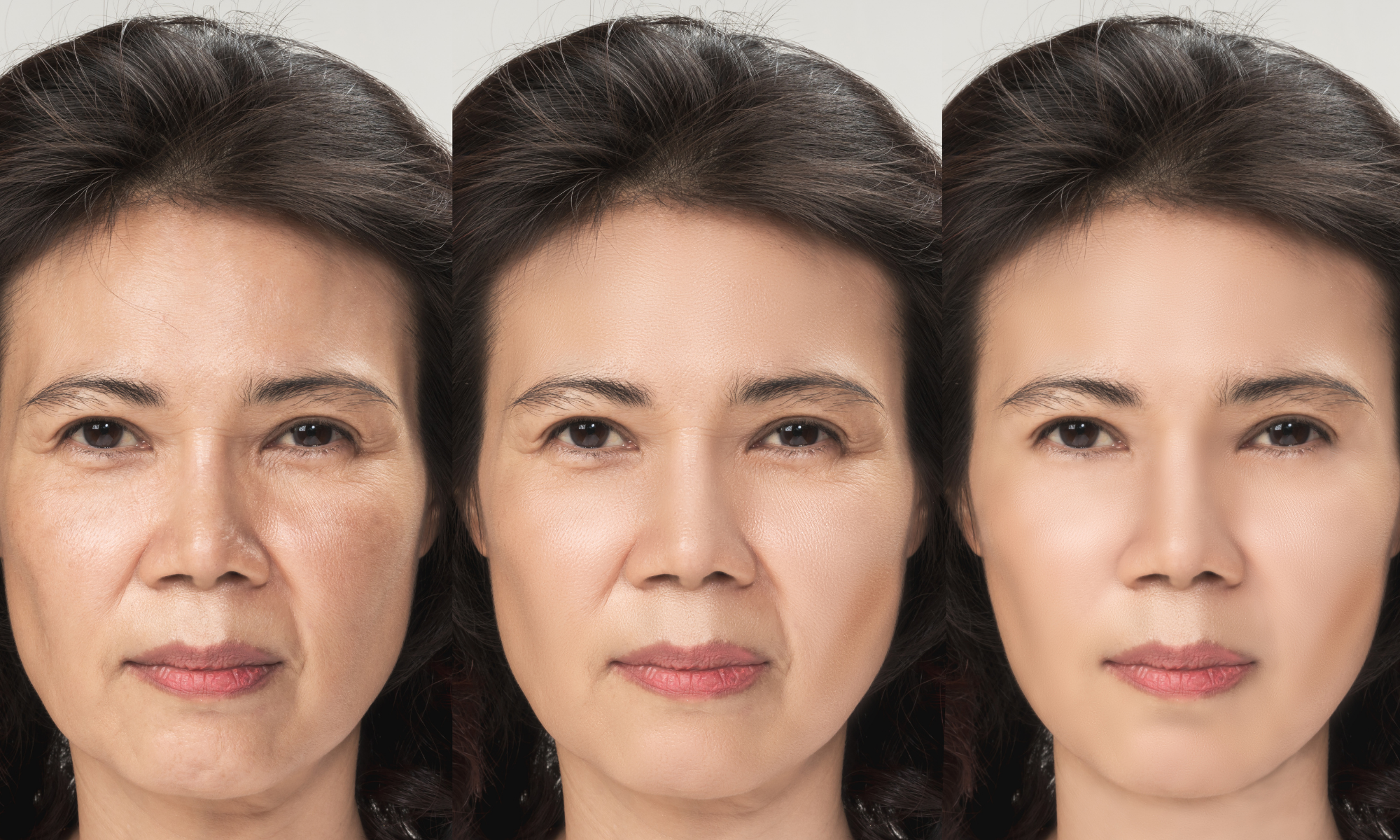 The same person in 3 frames, each picture looking more youthful than the previous The same person in 3 frames, each picture looking more youthful than the previous